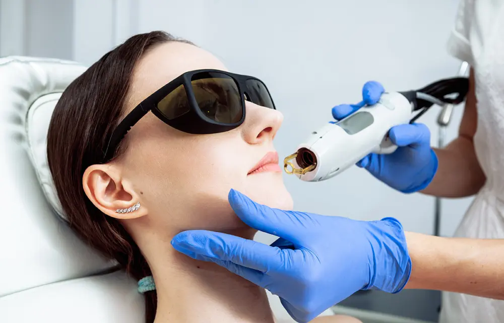 Intense Pulsed Light (IPL)